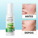 Spray Facial Hidratante de Aloe Vera