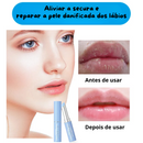 Lip Balm Protetor Labial enriquecido com Ácido Hialurônico - Hidratação e Nutrição