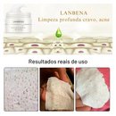 Máscara de Limpeza Nasal com Aloe Vera - Remova Cravos e Acnes com Eficácia Lanb